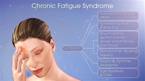 cfs symptoms in women.